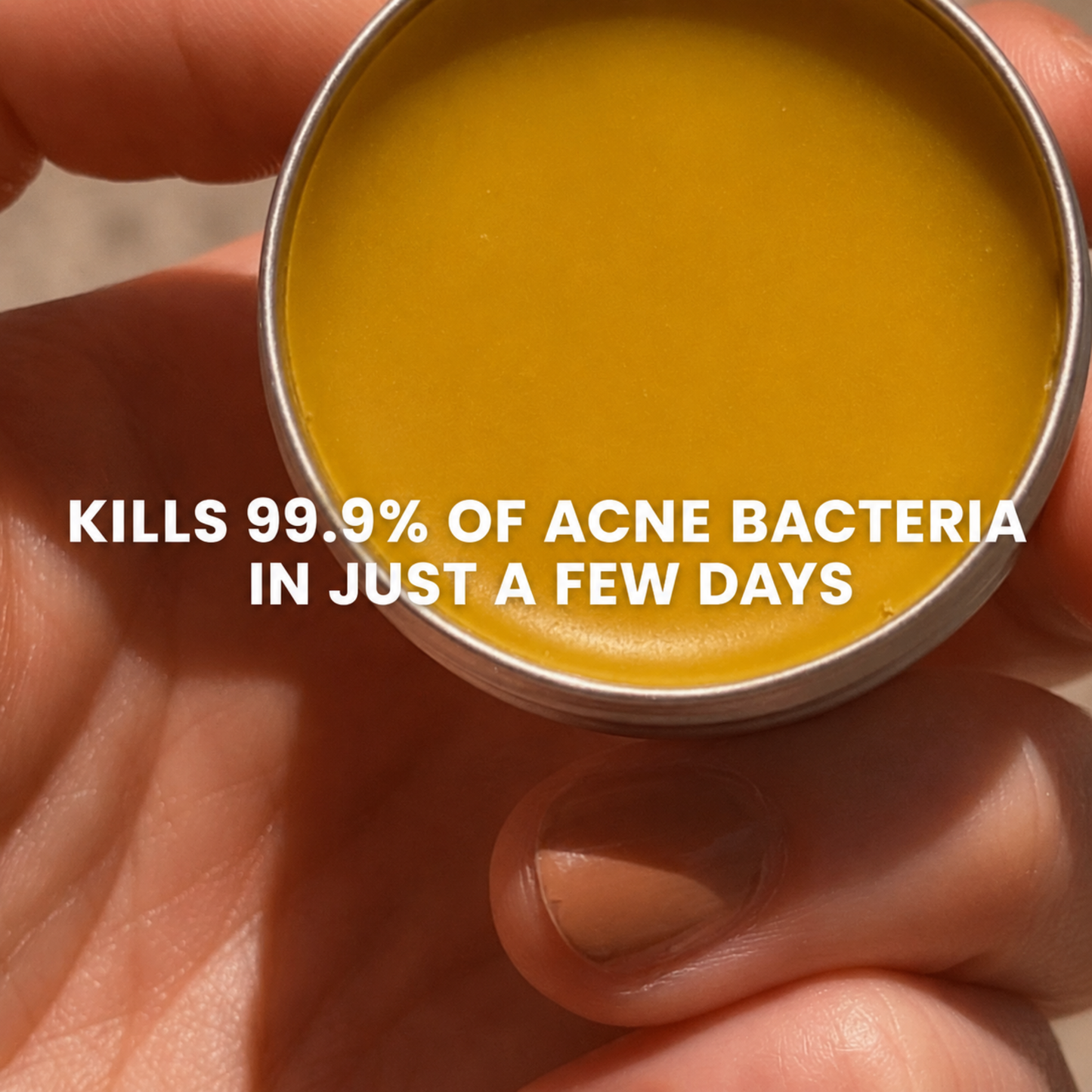 Redness & Acne Balm