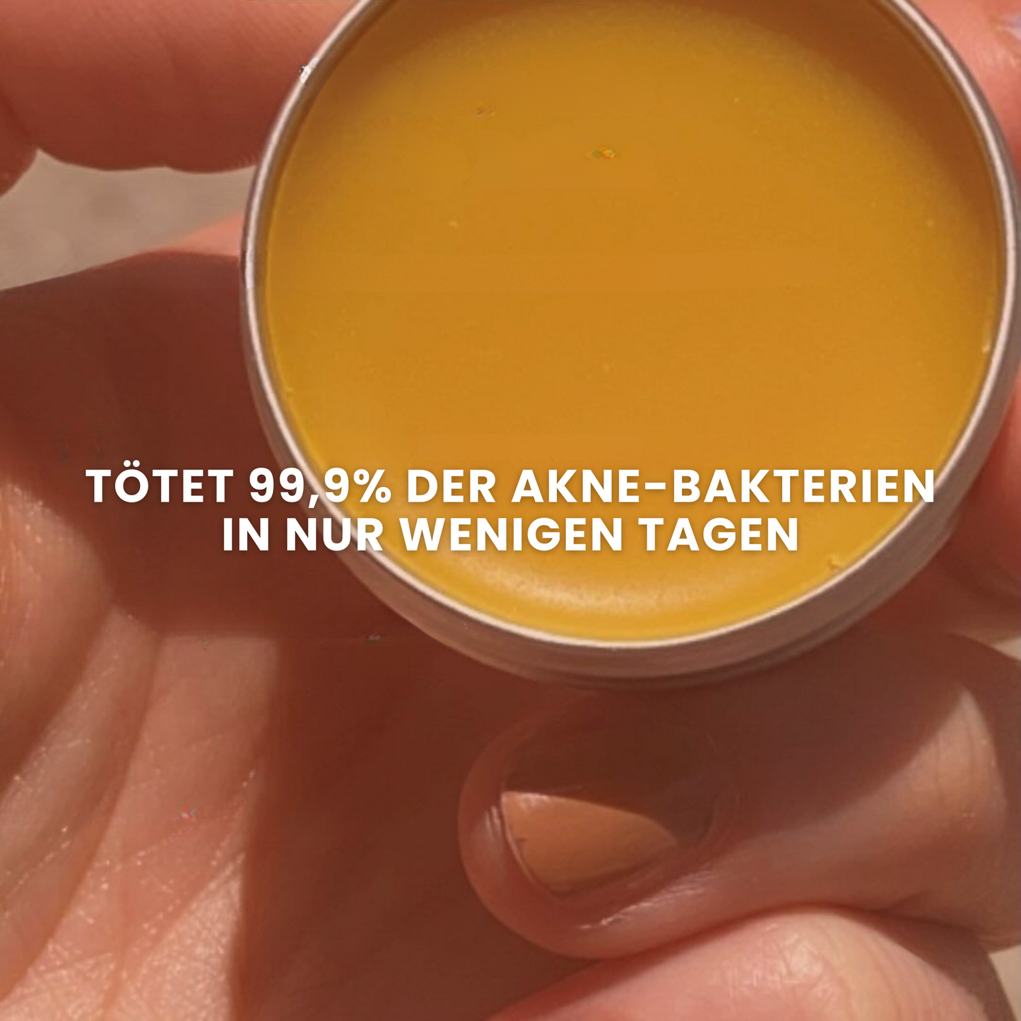 Redness & Acne Set 2