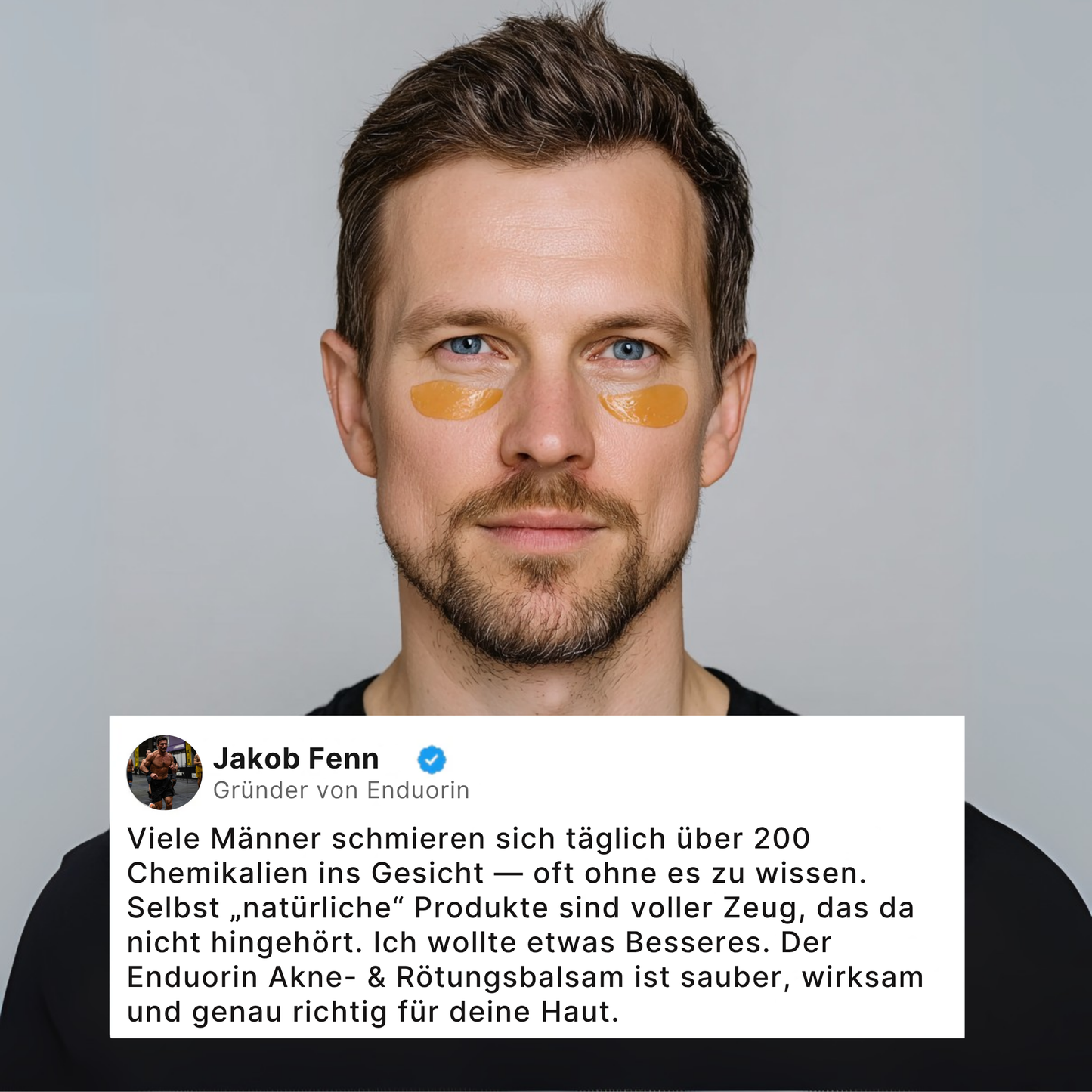 Redness & Acne Set 2