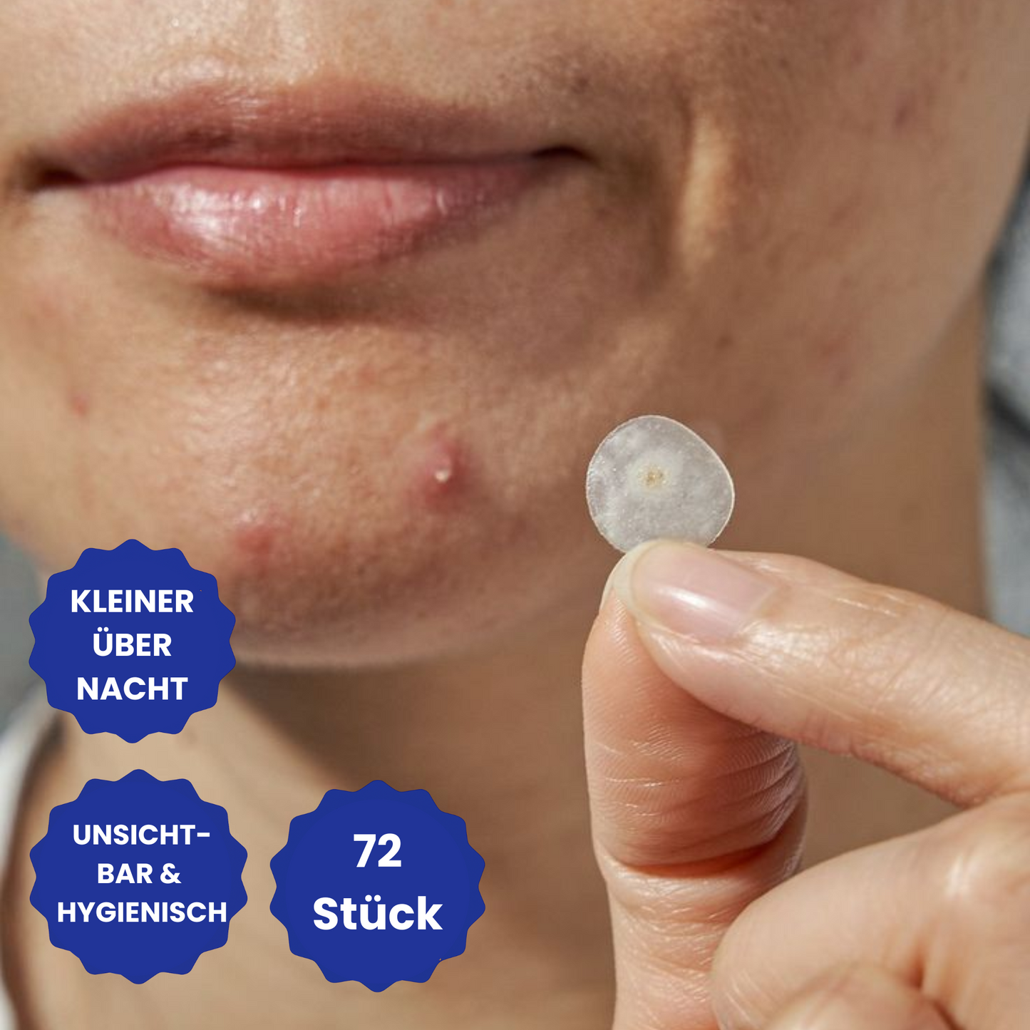 Anti-Pickel Notfall-Patches (72 Stück)