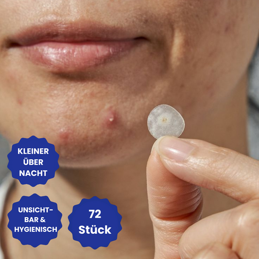 Anti-Pickel Notfall-Patches (72 Stück)