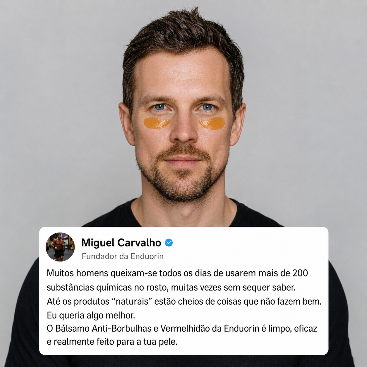 Bálsamo Para Borbulhas